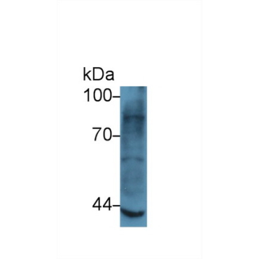 Matrix Metalloproteinase 3 (MMP3) Human Polyclonal Antibody