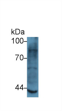Matrix Metalloproteinase 3 (MMP3) Human Polyclonal Antibody