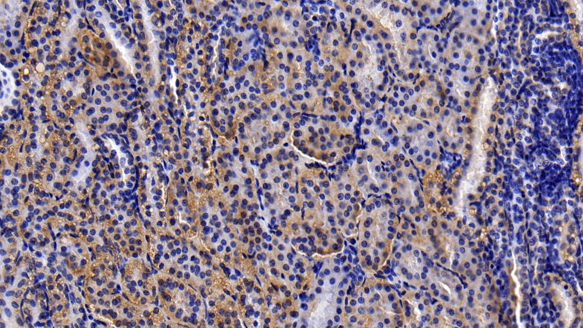 Matrix Metalloproteinase 3 (MMP3) Human Polyclonal Antibody