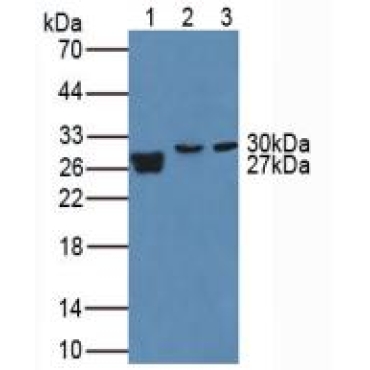 Matrix Metalloproteinase 7 (MMP7) Human Polyclonal Antibody