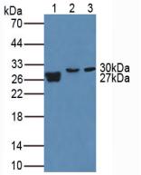Matrix Metalloproteinase 7 (MMP7) Human Polyclonal Antibody