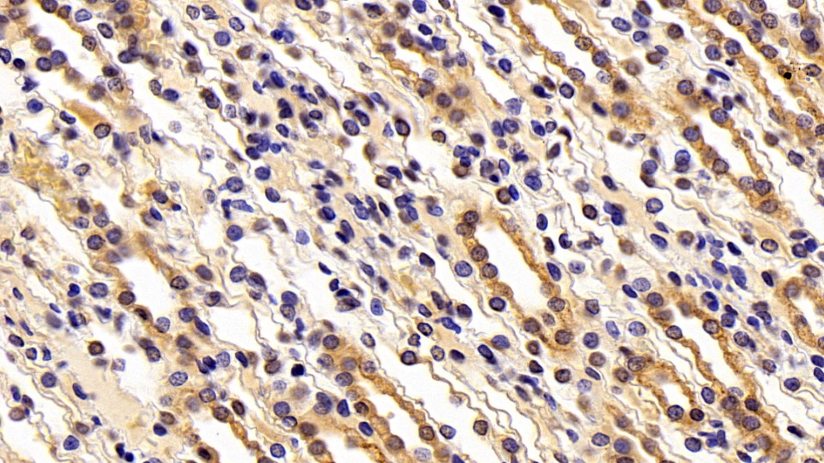 Matrix Metalloproteinase 7 (MMP7) Human Polyclonal Antibody