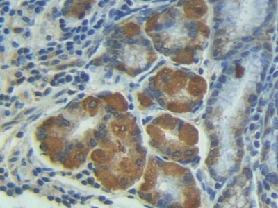 Matrix Metalloproteinase 7 (MMP7) Rat Polyclonal Antibody