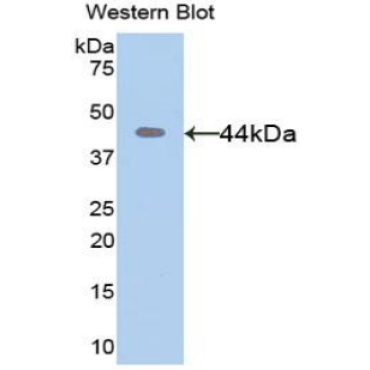 Matrix Metalloproteinase 8 (MMP8) Human Polyclonal Antibody
