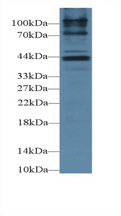 Cholecystokinin A Receptor (CCKAR) Human Polyclonal Antibody
