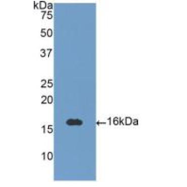Neurotrophin 3 (NT3) Human Polyclonal Antibody