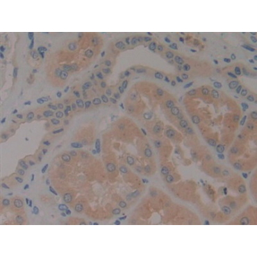 Neurotrophin 4 (NT4) Human Polyclonal Antibody