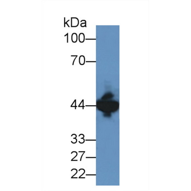 Creatine Kinase, Muscle (CKM) Human Polyclonal Antibody