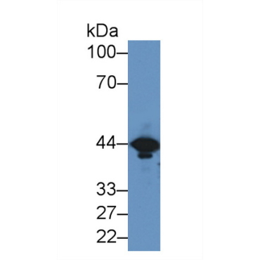 Creatine Kinase, Muscle (CKM) Mouse Polyclonal Antibody