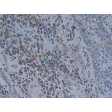 Oncostatin M (OSM) Human Polyclonal Antibody