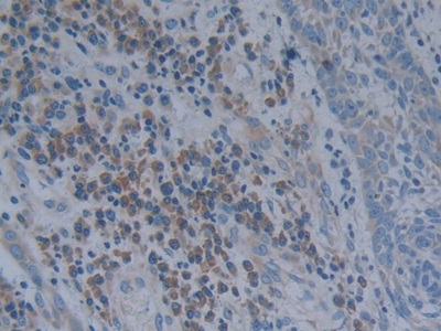 Oncostatin M (OSM) Human Polyclonal Antibody