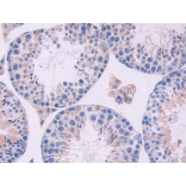 Oncostatin M (OSM) Mouse Polyclonal Antibody