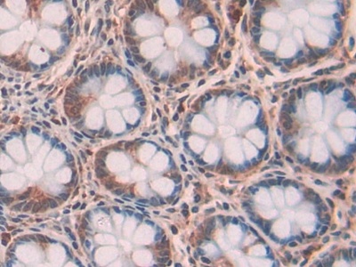 Ribonuclease T2 (RNASET2) Human Polyclonal Antibody