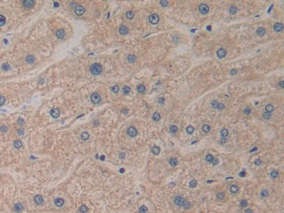 Prokineticin 2 (PK2) Human Polyclonal Antibody