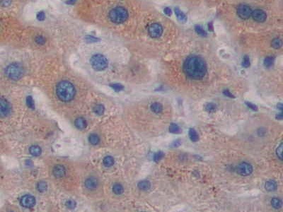 Regulated On Activation In Normal T-Cell Expressed And Secreted (RANTES) Rhesus monkey (Simian) Polyclonal Antibody