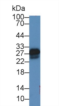 Superoxide Dismutase 3, Extracellular (SOD3) Rat Polyclonal Antibody