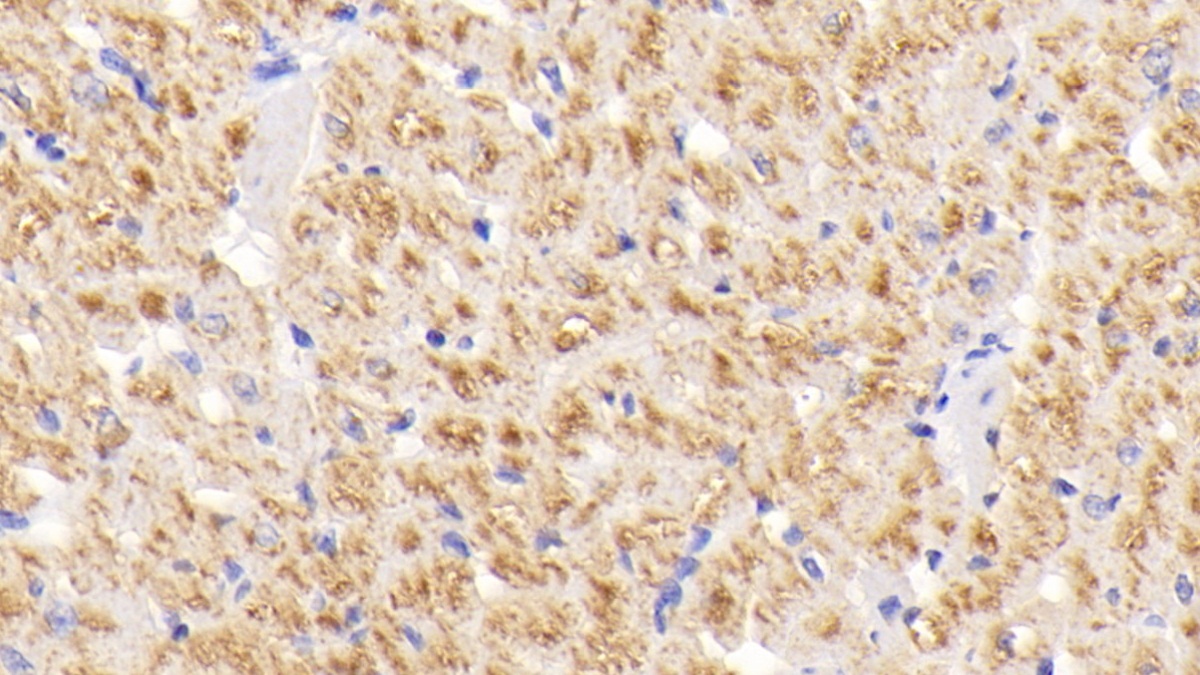 Superoxide Dismutase 3, Extracellular (SOD3) Rabbit Polyclonal Antibody