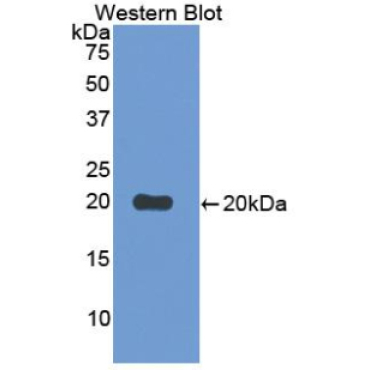 Cluster Of Differentiation 30 Ligand (CD30L) Human Polyclonal Antibody