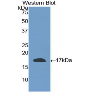 Cluster Of Differentiation 40 Ligand (CD40L) Human Polyclonal Antibody