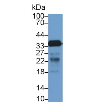 Cluster Of Differentiation 40 Ligand (CD40L) Human Polyclonal Antibody