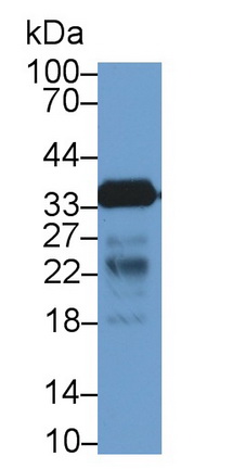 Cluster Of Differentiation 40 Ligand (CD40L) Human Polyclonal Antibody