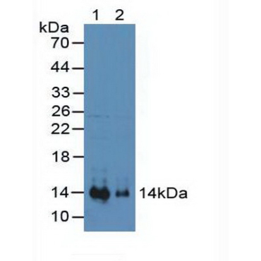 Stromal Cell Derived Factor 1 (SDF1) Human Polyclonal Antibody