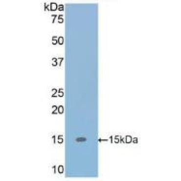 Transforming Growth Factor Beta 1 (TGFb1) Human Polyclonal Antibody
