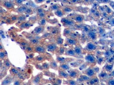 Transforming Growth Factor Beta 1 (TGFb1) Mouse Polyclonal Antibody