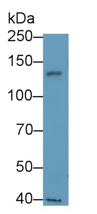 Tyrosine Kinase With Immunoglobulin Like And EGF Like Domains Protein 1 (Tie1) Human Polyclonal Antibody