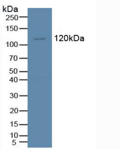 Tyrosine Kinase With Immunoglobulin Like And EGF Like Domains Protein 1 (Tie1) Human Polyclonal Antibody