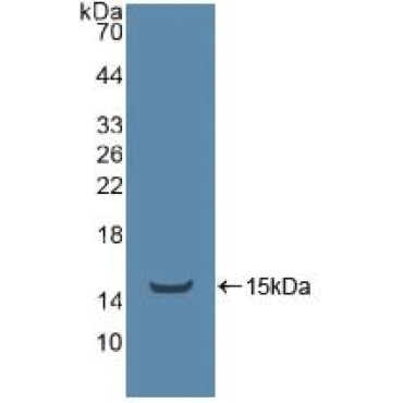 TEK Tyrosine Kinase, Endothelial (Tie2) Human Polyclonal Antibody