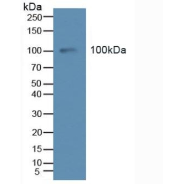 TEK Tyrosine Kinase, Endothelial (Tie2) Human Polyclonal Antibody