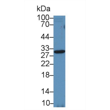 Tissue Inhibitors Of Metalloproteinase 2 (TIMP2) Equus caballus, Equine (Horse) Polyclonal Antibody