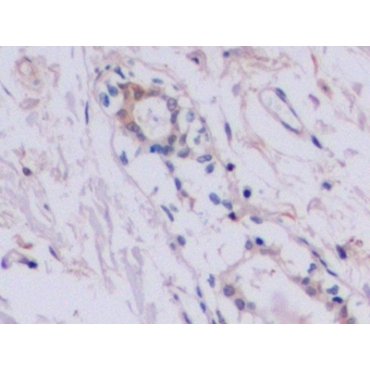 Tissue Inhibitors Of Metalloproteinase 2 (TIMP2) Human Polyclonal Antibody