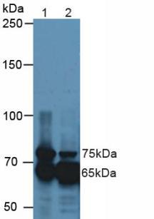 Transforming Growth Factor Beta Induced Protein (TGFbI) Mouse Polyclonal Antibody