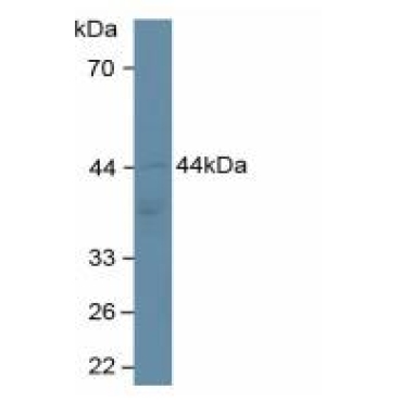 Adiponectin Receptor 2 (ADIPOR2) Human Polyclonal Antibody