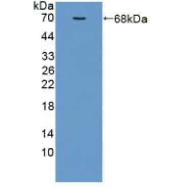 Adiponectin Receptor 2 (ADIPOR2) Human Polyclonal Antibody