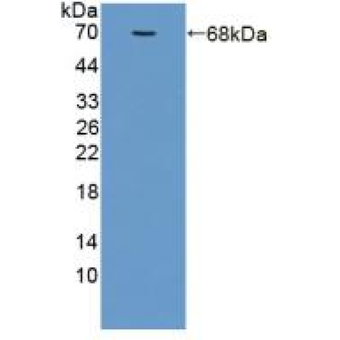 Adiponectin Receptor 2 (ADIPOR2) Human Polyclonal Antibody