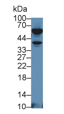 Tumor Necrosis Factor Beta (TNFb) Mouse Polyclonal Antibody