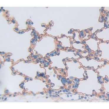 Tumor Necrosis Factor Receptor Superfamily, Member 10C (TNFRSF10C) Human Polyclonal Antibody