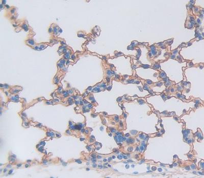 Tumor Necrosis Factor Receptor Superfamily, Member 10C (TNFRSF10C) Human Polyclonal Antibody