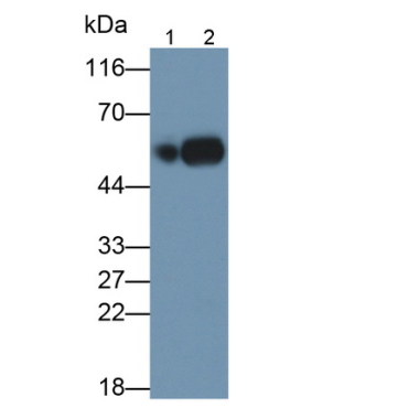 Plasminogen Activator, Urokinase (uPA) Human Polyclonal Antibody