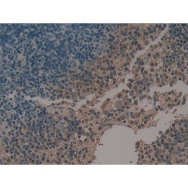 Plasminogen Activator, Urokinase (uPA) Mouse Polyclonal Antibody