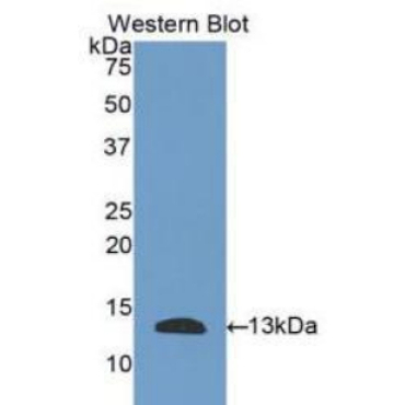 Plasminogen Activator, Urokinase Receptor (uPAR) Human Polyclonal Antibody