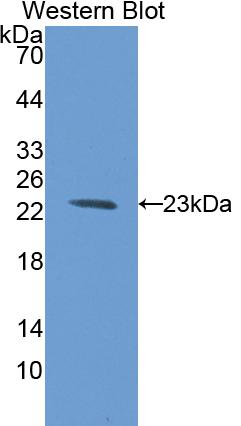 Plasminogen Activator, Urokinase Receptor (uPAR) Rat Polyclonal Antibody