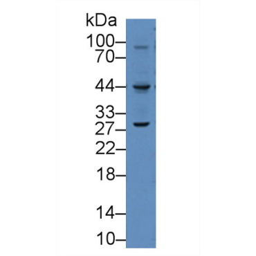 Vascular Endothelial Growth Factor C (VEGFC) Human Polyclonal Antibody