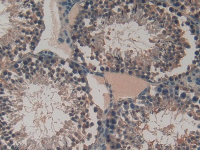Vascular Endothelial Growth Factor C (VEGFC) Mouse Polyclonal Antibody