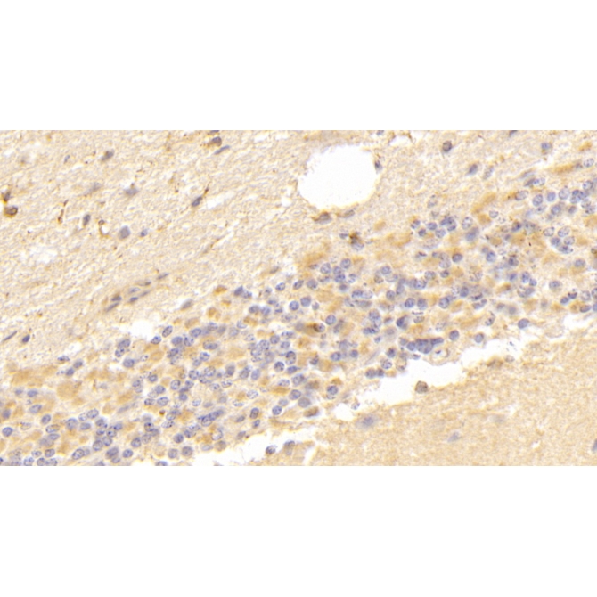 Vascular Endothelial Growth Factor D (VEGFD) Human Polyclonal Antibody