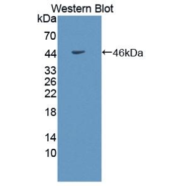 Adiponectin Receptor 1 (ADIPOR1) Human Polyclonal Antibody