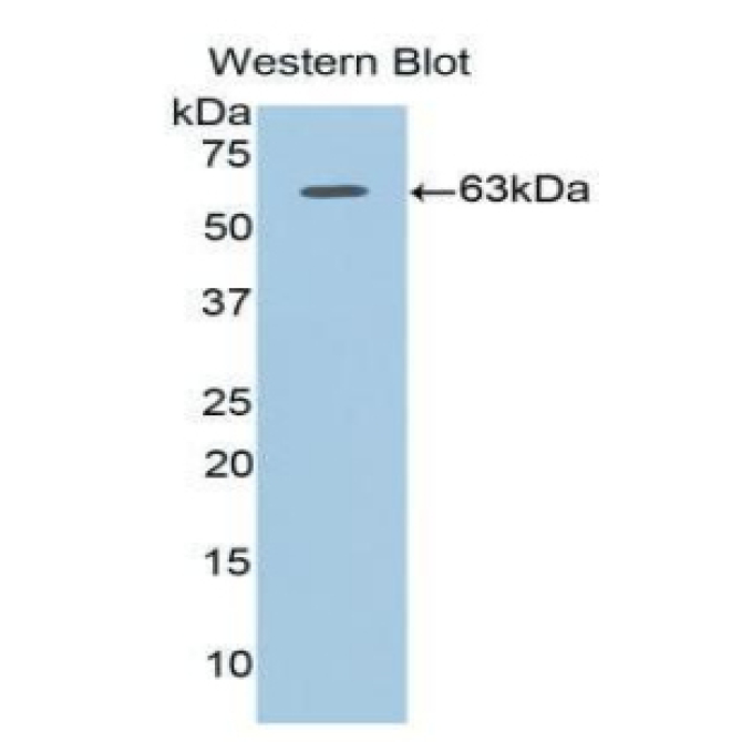 Adiponectin Receptor 1 (ADIPOR1) Human Polyclonal Antibody